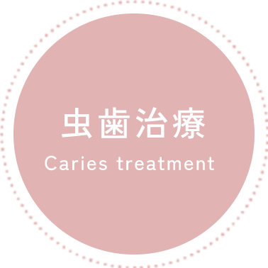 虫歯治療