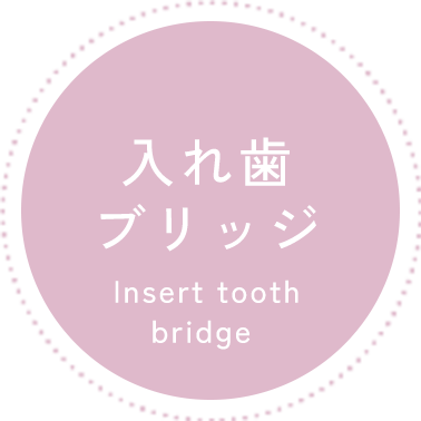 入れ歯、ブリッジ
